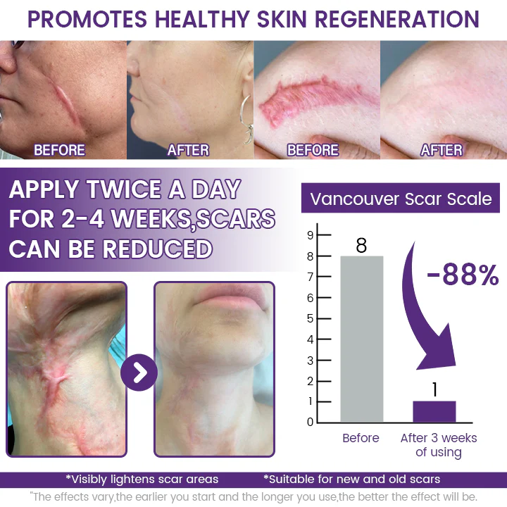 Timilk Regenscar Stem Cell Scar Gel 20g – photo 2