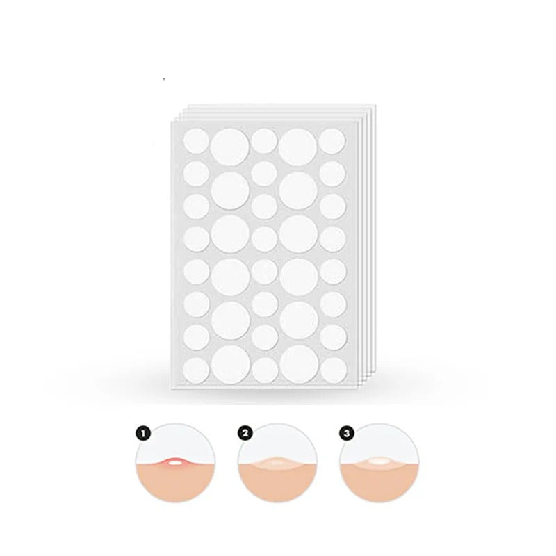 Glamorous Face Acne Pimple Patch �72 Patches Hydrocolloid Invisible Spot Treatment for Pimples & Acne (Only 1 Packet)