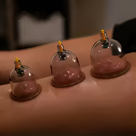 10-Piece Hijama Cupping Therapy Set �Vacuum Suction Massage Cups with Pull-Out Pump | Pain Relief, Blood Circulation, Relaxation & Muscle Recovery Kit