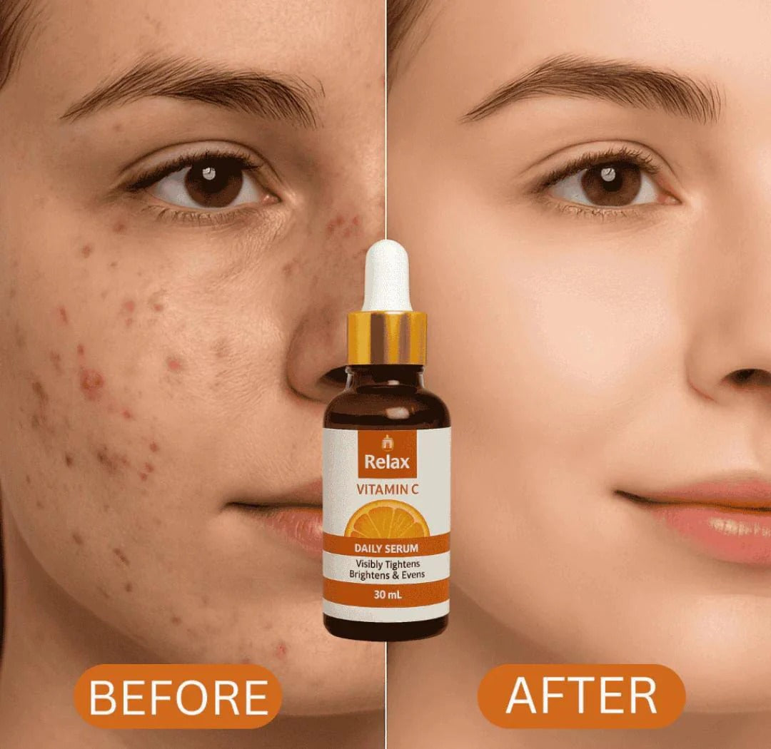 Relax Vitamin C Daily Face Serum �Brightening, Anti-Aging & Hydrating Formula for Healthy Radiant Skin (30ml)