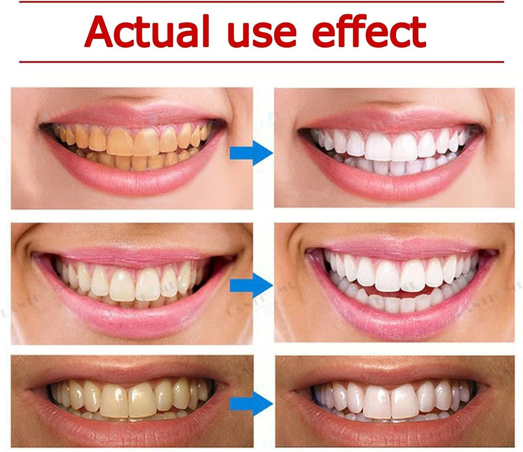 Yayashi SP-4 Ultra Whitening Toothpaste �150ml Probiotic Stain Remover for Bright, Healthy Teeth