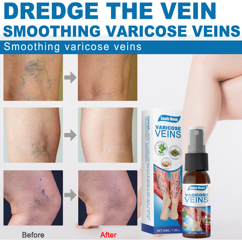 30ml Varicose Veins Treatment Spray Varicose Vein – photo 2