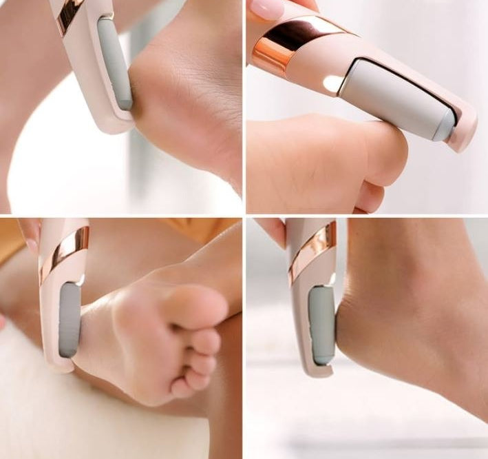 Rechargeable Electric Pedi Foot Filer �Effective Callus Remover for Soft, Smooth Feet