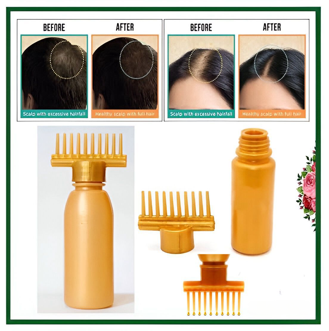 (Pack of 20) Hair dye bottle | Hair Oil Applicator Bottle, Root oiling Comb bottle for Hair Coloring, Shampoo, Oiling, Dye, and Scalp Treatment for home &amp; commercial ( Empty Bottle)