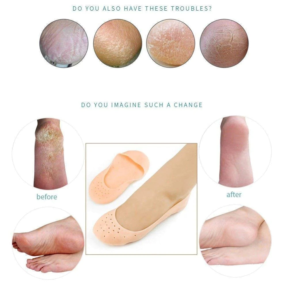 1 Pair unisex silicone gel socks moisturizing – photo 2